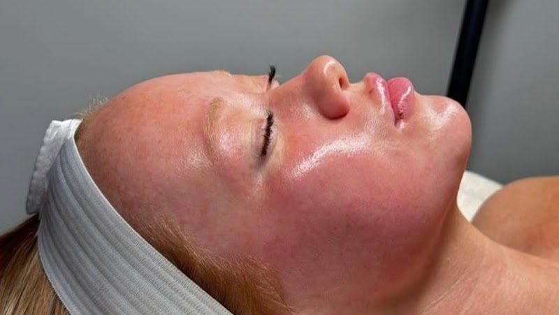 Beauti4Skin Medspa n Laser